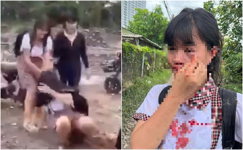 Nữ sinh bị hành hung dã man ở TP.Thủ Đức, TP.HCM. (Ảnh: Thanh niên)