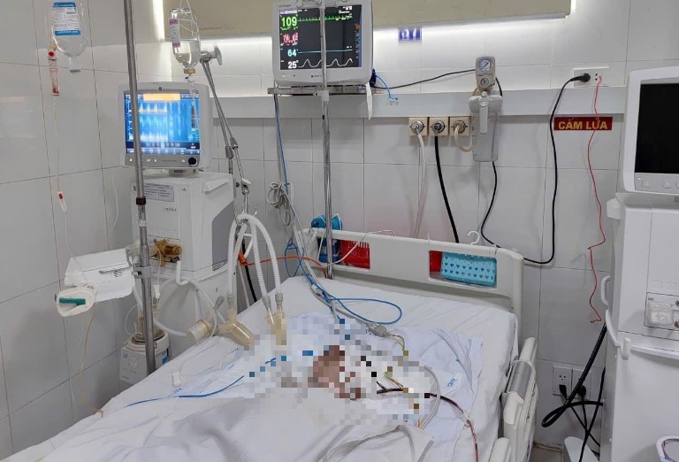 Một nạn nhân 1 tuổi bị chấn thương sọ não, nguy kịch. Ảnh: Bệnh viện cung cấp